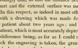 BRIGHT, Richard (1789-1858) Reports of medical cases