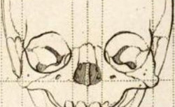 CAMPER, Petrus (1722-1789) Dissertation physique