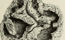 COOPER, Astley (1768-1841) The Anatomy of the Thymus Gland