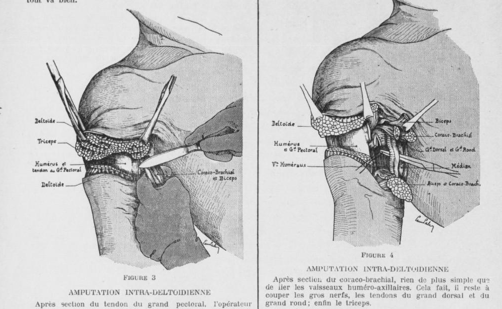 Accéder à la page "Gazette médicale de France et des pays de langue française (La)"