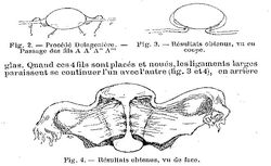 Accéder à la page "Semaine gynécologique (La)"