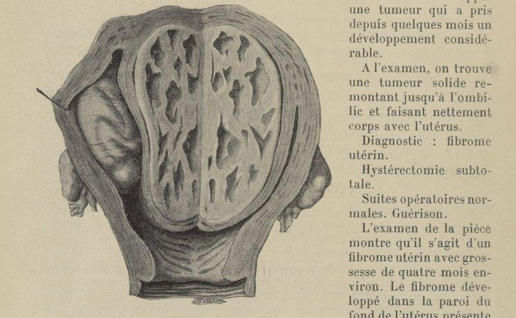 Accéder à la page "Obstétrique (L')"